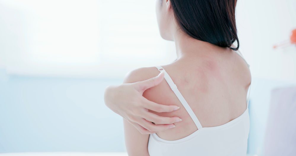 Comment traiter la peau sèche naturellement, comme la peau du dos qui peut être rouge ?